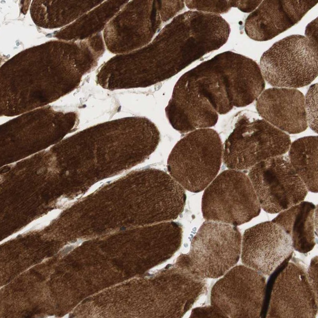 BIN1 Antibody in Immunohistochemistry (Paraffin) (IHC (P))