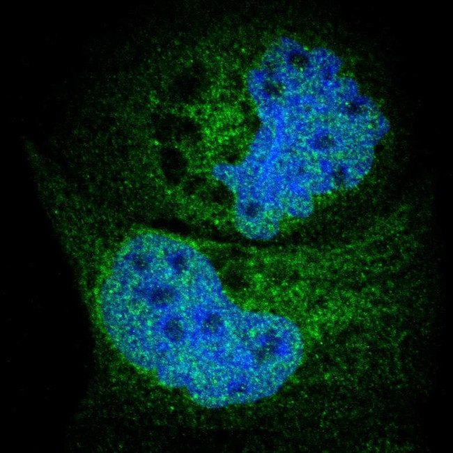 HRD1 Antibody in Immunocytochemistry (ICC/IF)