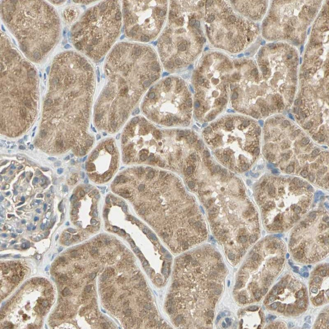 cIAP1 Antibody in Immunohistochemistry (Paraffin) (IHC (P))