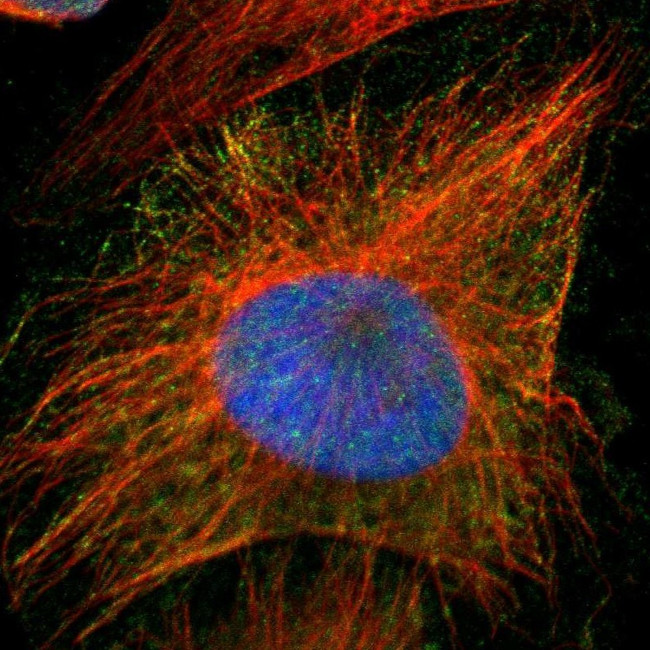 PRMT5 Antibody in Immunocytochemistry (ICC/IF)