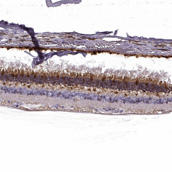 GCAP1 Antibody in Immunohistochemistry (Paraffin) (IHC (P))