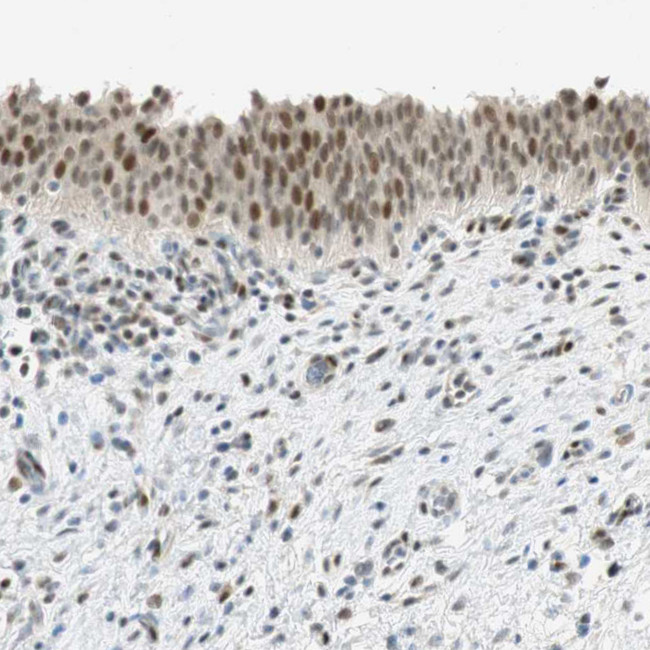 MSX2 Antibody in Immunohistochemistry (Paraffin) (IHC (P))