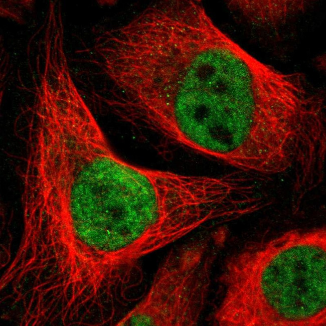 DLX5 Antibody in Immunocytochemistry (ICC/IF)