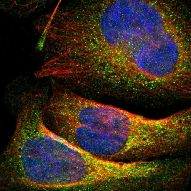 15-PGDH Antibody in Immunocytochemistry (ICC/IF)