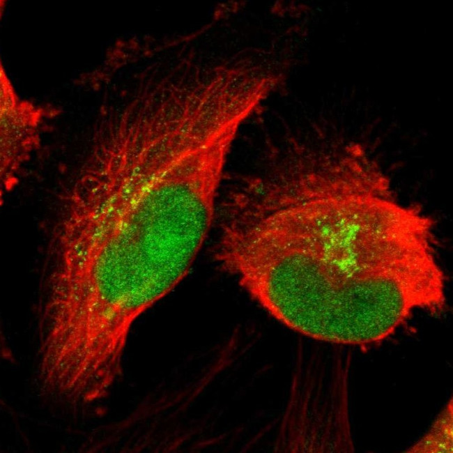 PRDM2 Antibody in Immunocytochemistry (ICC/IF)