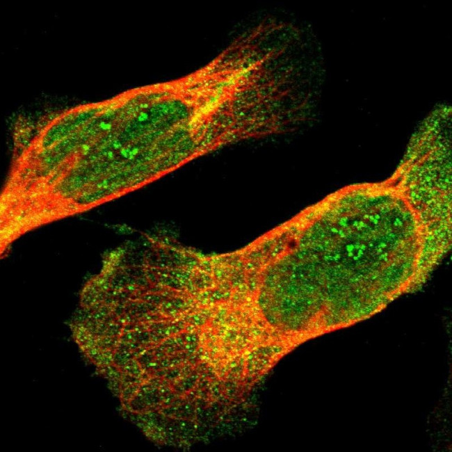 IkB epsilon Antibody in Immunocytochemistry (ICC/IF)