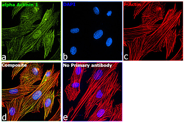 alpha Actinin 1 Antibody in Immunocytochemistry (ICC/IF)