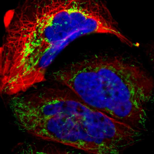 ACADM Antibody in Immunocytochemistry (ICC/IF)