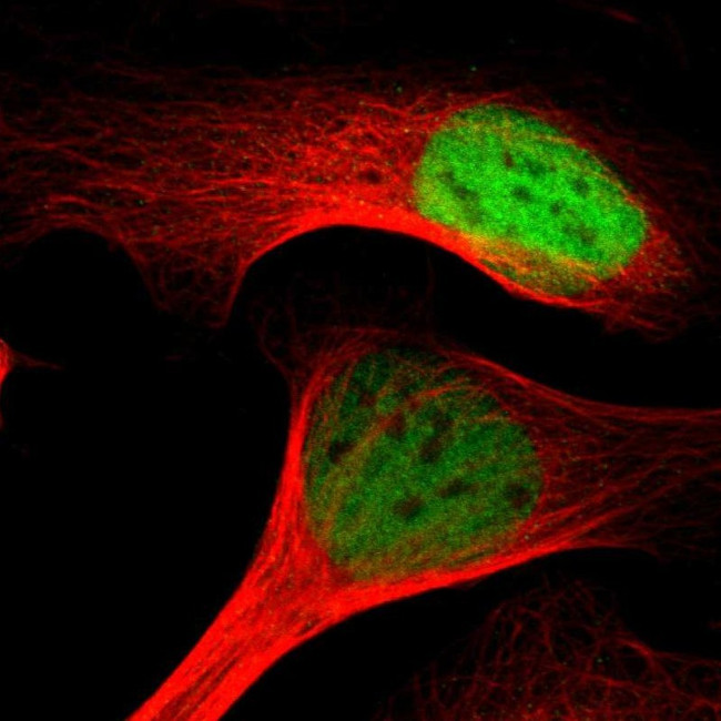 MTA2 Antibody in Immunocytochemistry (ICC/IF)