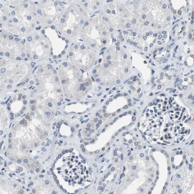 TCP1 Antibody in Immunohistochemistry (Paraffin) (IHC (P))