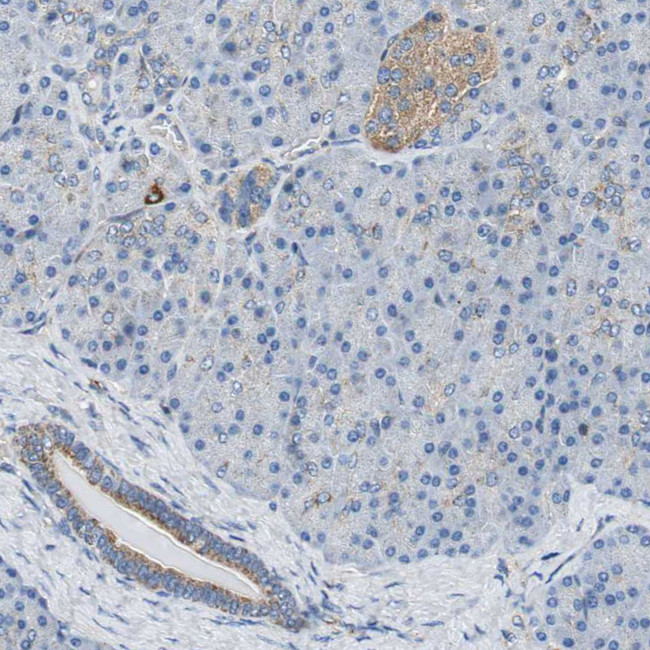 GSTK1 Antibody in Immunohistochemistry (Paraffin) (IHC (P))