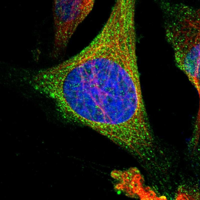 HPRT1 Antibody in Immunocytochemistry (ICC/IF)