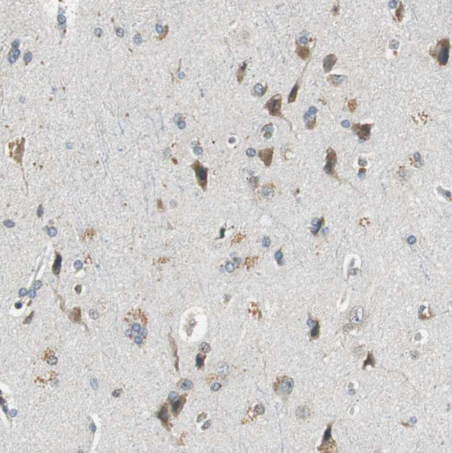 ALDH4A1 Antibody in Immunohistochemistry (Paraffin) (IHC (P))