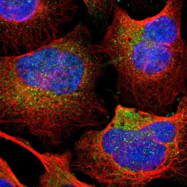 TIP30 Antibody in Immunocytochemistry (ICC/IF)