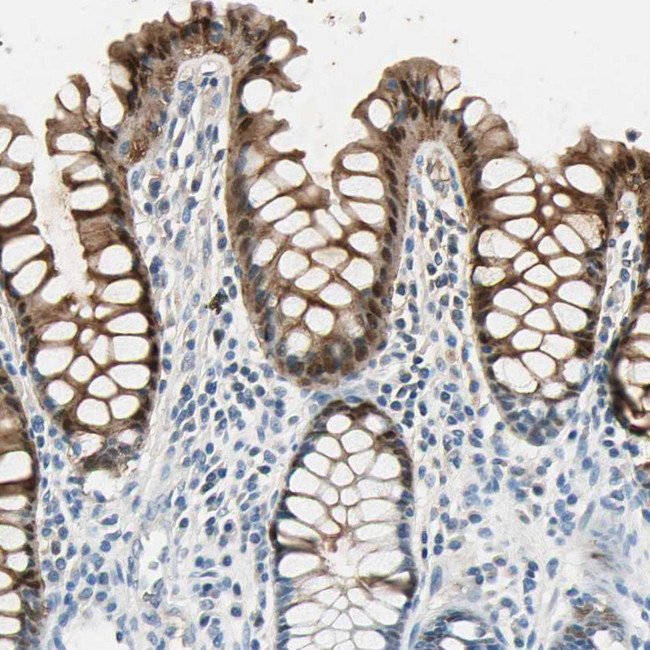 Carbonic Anhydrase I Antibody in Immunohistochemistry (Paraffin) (IHC (P))