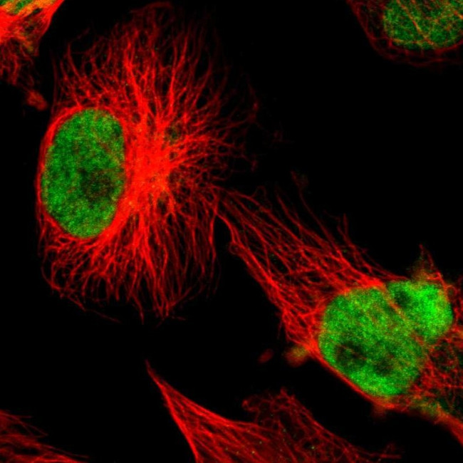 XRCC1 Antibody in Immunocytochemistry (ICC/IF)