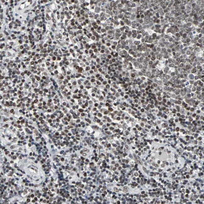 PNK Antibody in Immunohistochemistry (Paraffin) (IHC (P))