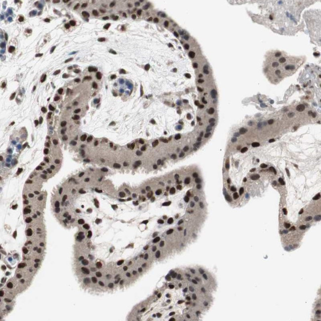 RPA70 Antibody in Immunohistochemistry (Paraffin) (IHC (P))