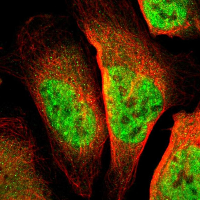 TSHZ1 Antibody in Immunocytochemistry (ICC/IF)