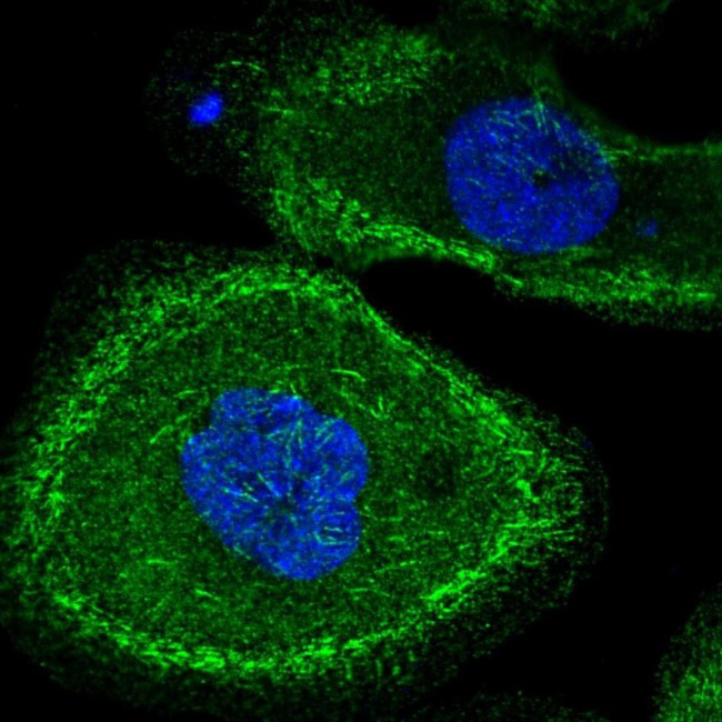 MLK2 Antibody in Immunocytochemistry (ICC/IF)