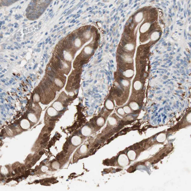 KHK Antibody in Immunohistochemistry (Paraffin) (IHC (P))