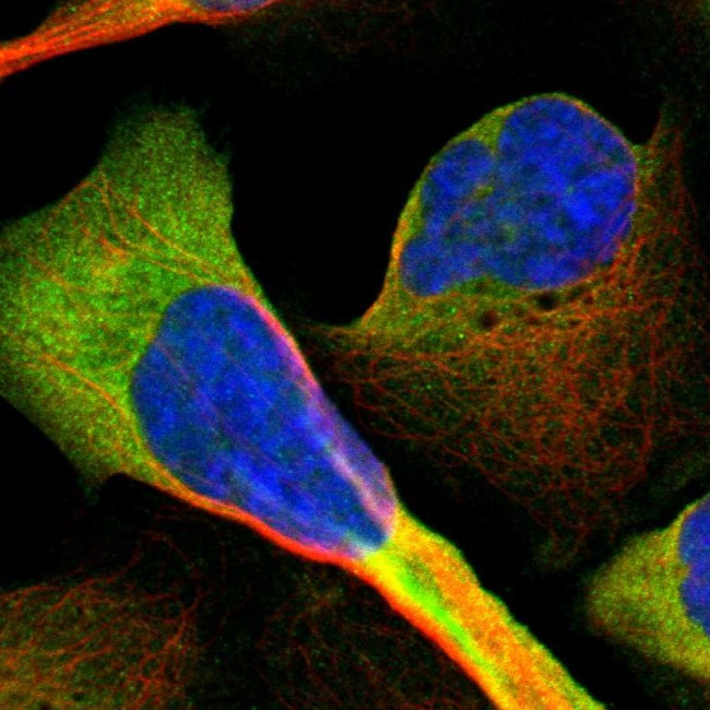 CD81 Antibody in Immunocytochemistry (ICC/IF)