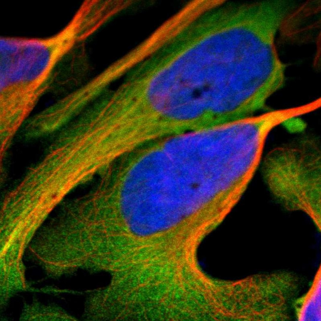 NQO1 Antibody in Immunocytochemistry (ICC/IF)