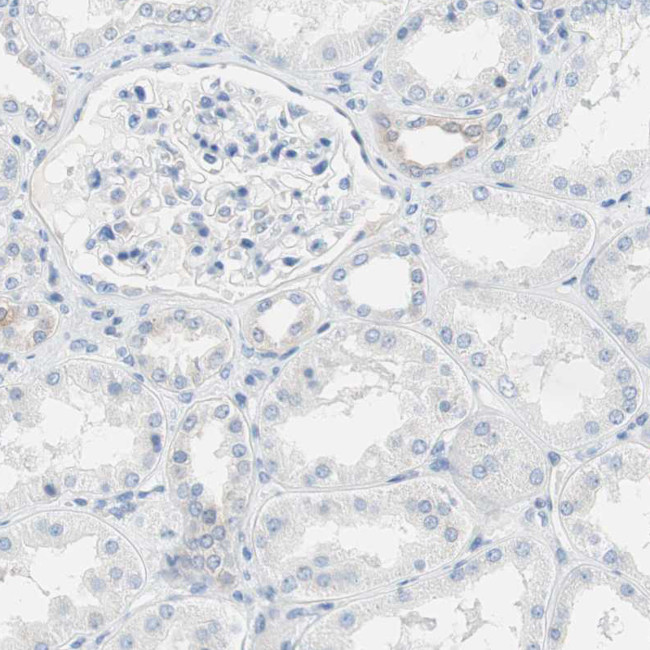 Glutamine Synthetase Antibody in Immunohistochemistry (Paraffin) (IHC (P))