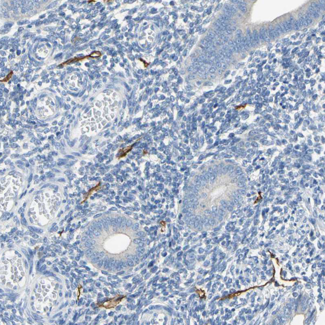 Podoplanin Antibody in Immunohistochemistry (Paraffin) (IHC (P))