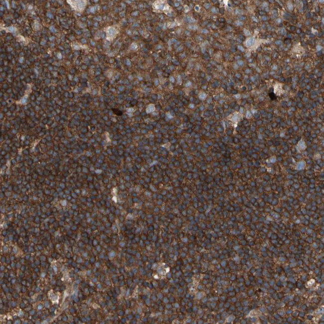 ROCK1 Antibody in Immunohistochemistry (Paraffin) (IHC (P))