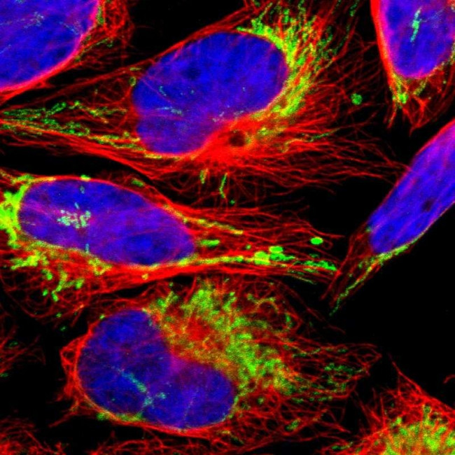 ACAT1 Antibody in Immunocytochemistry (ICC/IF)