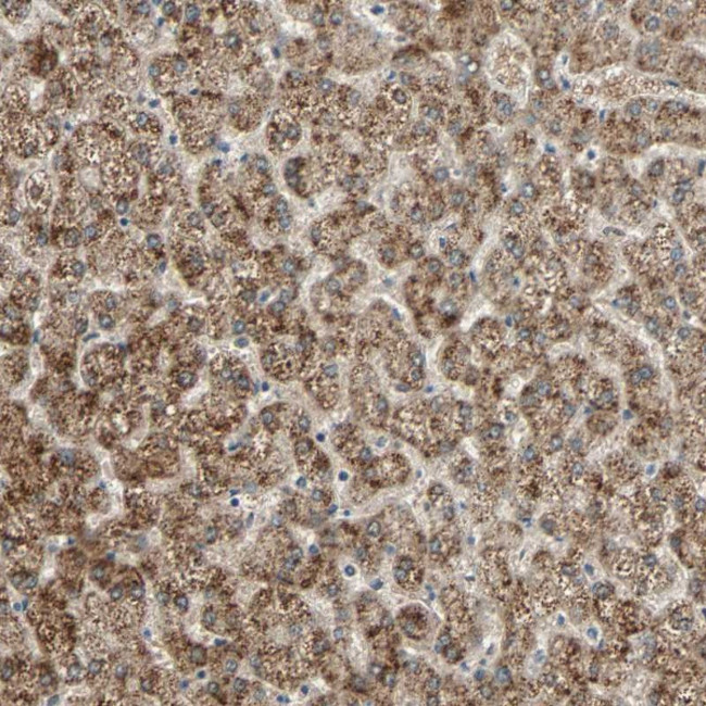 PHYH Antibody in Immunohistochemistry (Paraffin) (IHC (P))