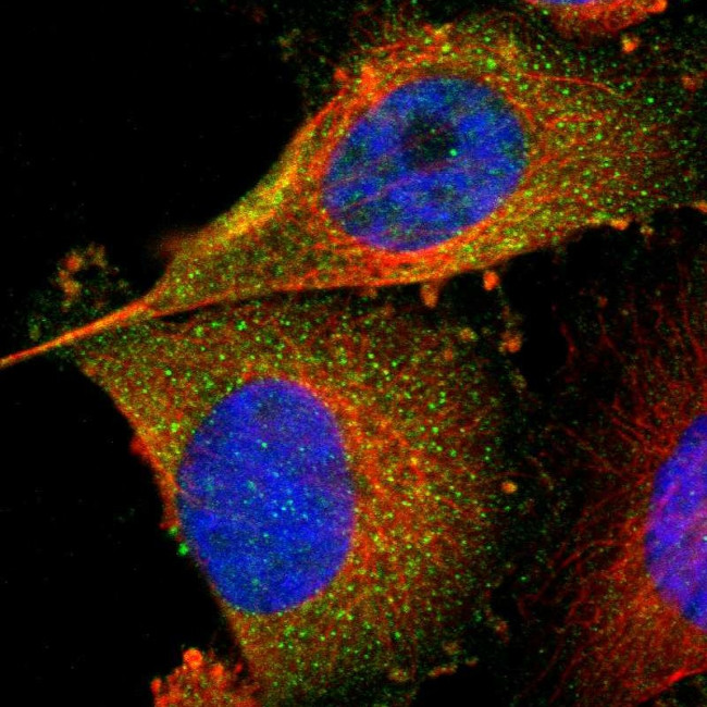 FER Antibody in Immunocytochemistry (ICC/IF)