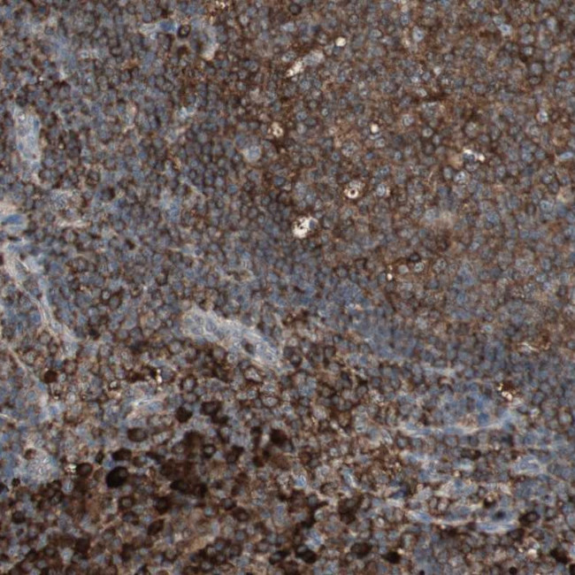 MMP3 Antibody in Immunohistochemistry (Paraffin) (IHC (P))