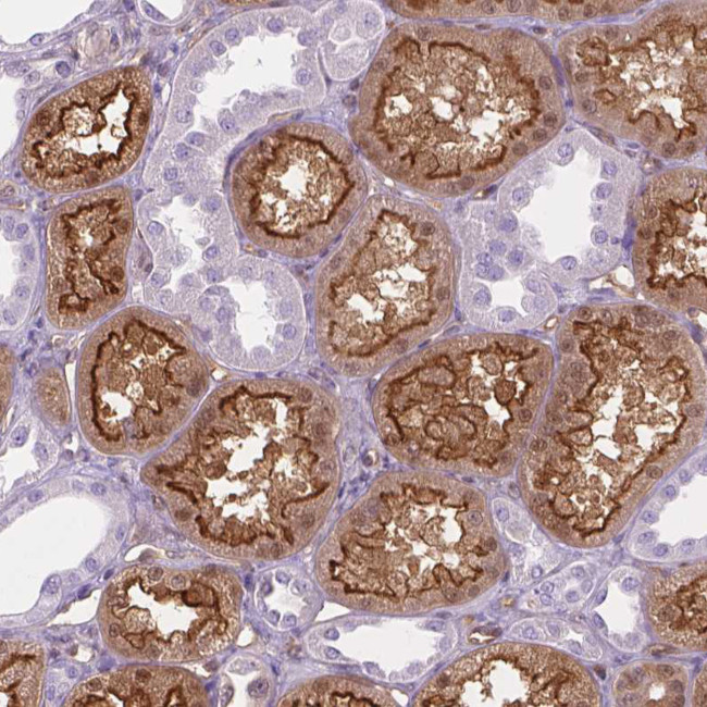 CLIC4 Antibody in Immunohistochemistry (Paraffin) (IHC (P))