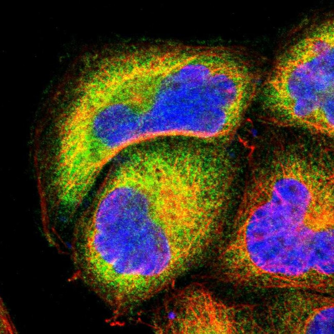 NFkB p100 Antibody in Immunocytochemistry (ICC/IF)