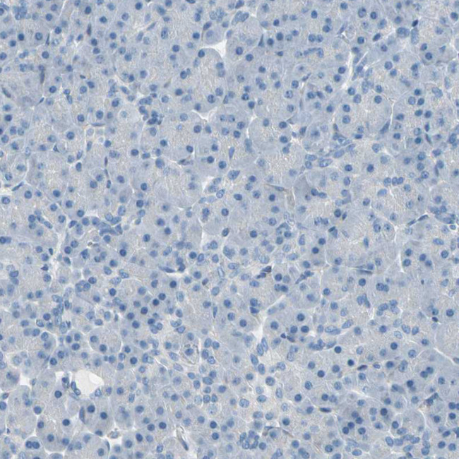 Progesterone Receptor Antibody in Immunohistochemistry (Paraffin) (IHC (P))