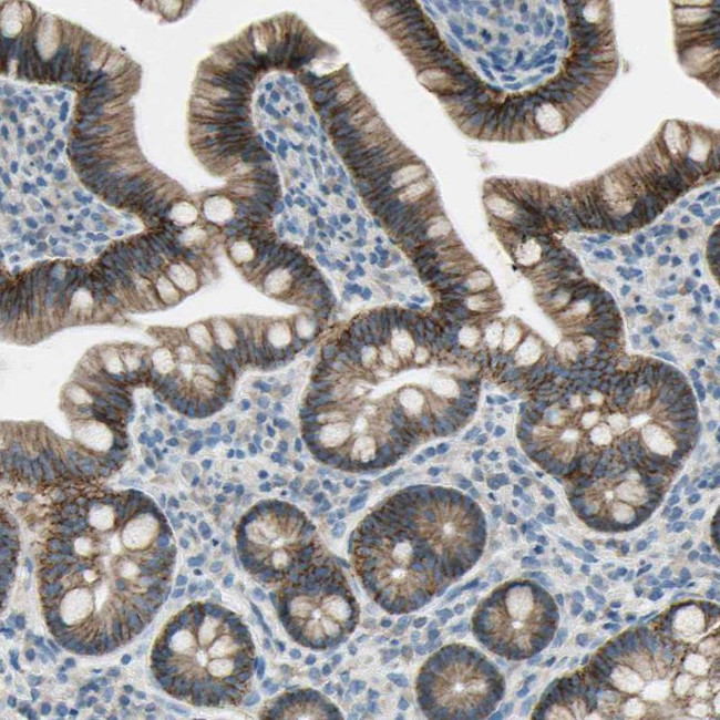 ITGA3 Antibody in Immunohistochemistry (Paraffin) (IHC (P))