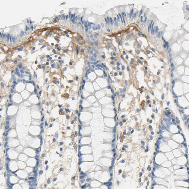 TGFBI Antibody in Immunohistochemistry (Paraffin) (IHC (P))