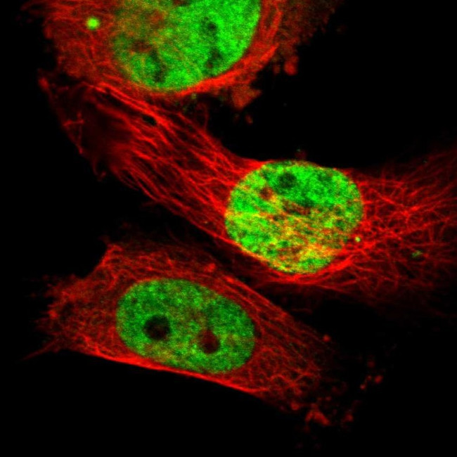 SUFU Antibody in Immunocytochemistry (ICC/IF)