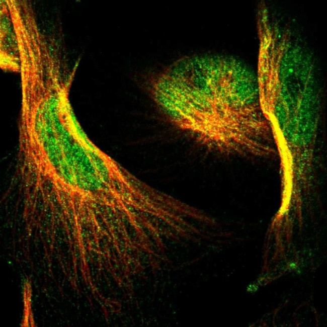 NFATC2 Antibody in Immunocytochemistry (ICC/IF)