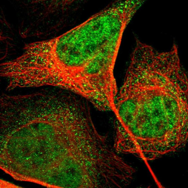 Ephrin B2 Antibody in Immunocytochemistry (ICC/IF)