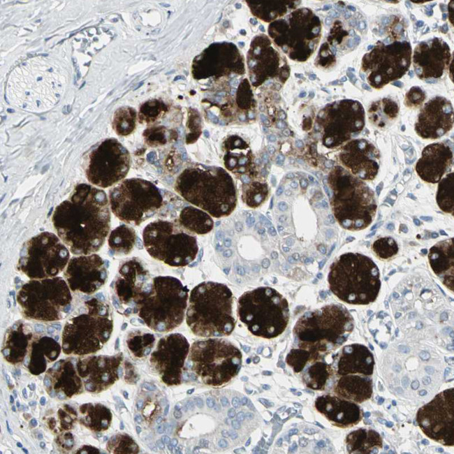 GCDFP-15 Antibody in Immunohistochemistry (Paraffin) (IHC (P))