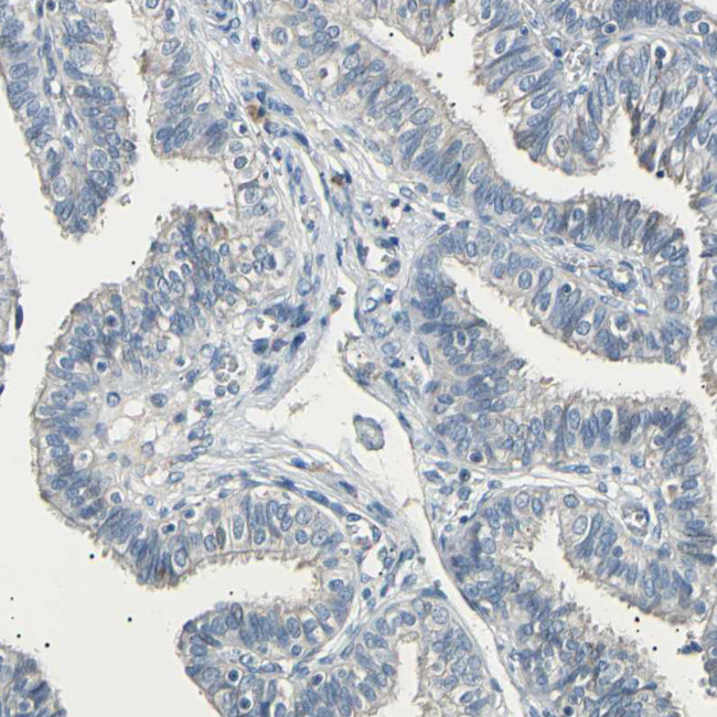 LDLR Antibody in Immunohistochemistry (Paraffin) (IHC (P))