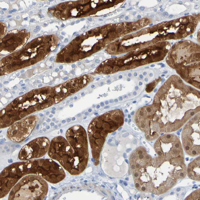 ACMSD Antibody in Immunohistochemistry (Paraffin) (IHC (P))