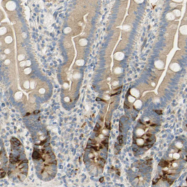 KIF11 Antibody in Immunohistochemistry (Paraffin) (IHC (P))