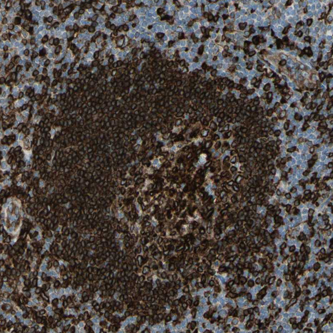 CD74 Antibody in Immunohistochemistry (Paraffin) (IHC (P))