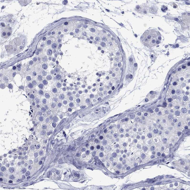 CD1a Antibody in Immunohistochemistry (Paraffin) (IHC (P))