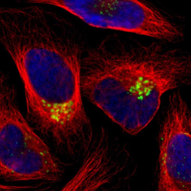 GALNT2 Antibody in Immunocytochemistry (ICC/IF)