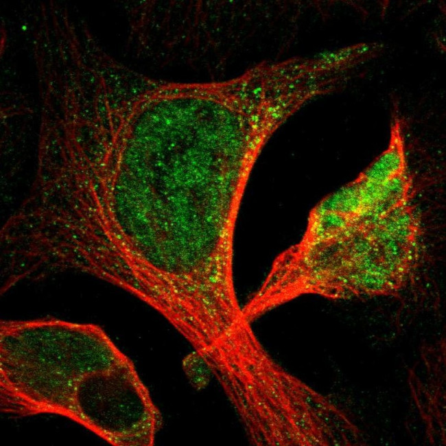 ACSL1 Antibody in Immunocytochemistry (ICC/IF)